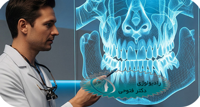 CBCT ناحیه سر و گردن در شهر قدس | رادیولوژی تخصصی دهان، فک و صورت دکتر حسین فتوحی