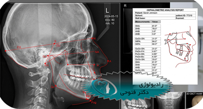 رادیولوژی در ارتودنسی | سفالومتری، CBCT و فتوگرافی تخصصی  | دکتر حسین فتوحی